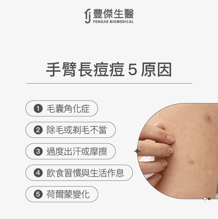 手臂長痘痘5原因：毛囊角化症、除毛或剃毛不當、過度出汗或摩擦、飲食習慣與生活作息、荷爾蒙變化