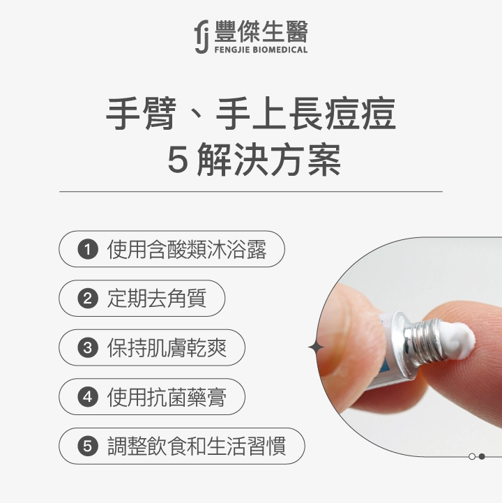 手臂、手上長痘痘5解決方案：使用含酸類沐浴露、定期去角質、保持肌膚乾爽、使用抗菌藥膏、調整飲食和生活習慣