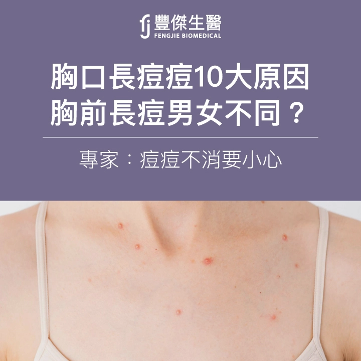 胸口長痘痘10大原因，胸前長痘男女不同？專家：痘痘不消要小心