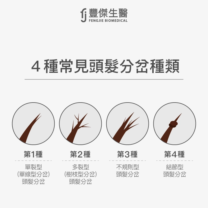 髮尾分岔4種常見種類：單裂型（單線型分岔）、多裂型（樹枝型分岔）、不規則型、結節型