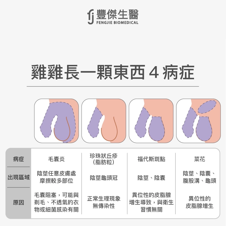 雞雞長一顆東西4病症：毛囊炎、珍珠狀丘疹（脂肪粒）、福代斯斑點、菜花