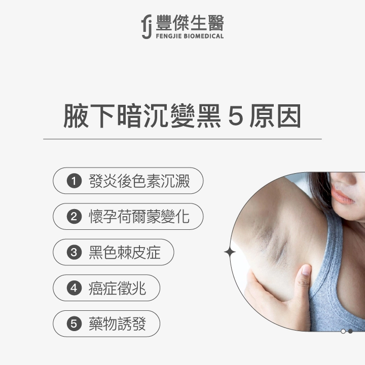 腋下暗沉變黑5原因:發炎後色素沉澱、懷孕荷爾蒙變化、黑色棘皮症、癌症徵兆、藥物誘發