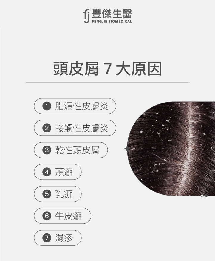 頭皮屑7大原因：脂漏性皮膚炎、接觸性皮膚炎、乾性頭皮屑、頭癬、乳痂、牛皮癬、濕疹