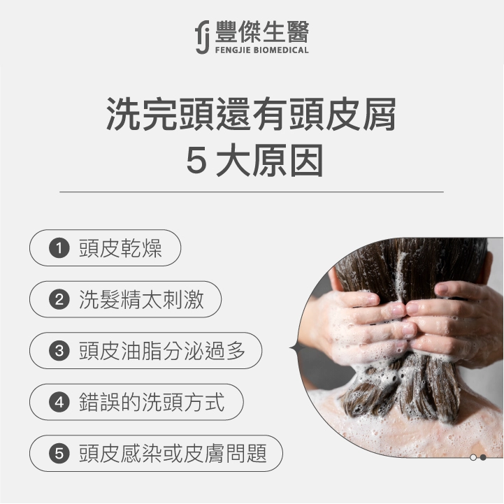 洗完頭還有頭皮屑5大原因：頭皮乾燥、洗髮精太刺激、頭皮油脂分泌過多、錯誤的洗頭方式、頭皮感染或皮膚問題