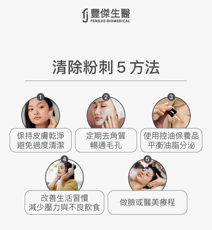 清除粉刺5方法：保持皮膚乾淨避免過度清潔、定期去角質暢通毛孔、使用控油保養品平衡油脂分泌、改善生活習慣減少壓力與不良飲食、做臉或醫美療程。