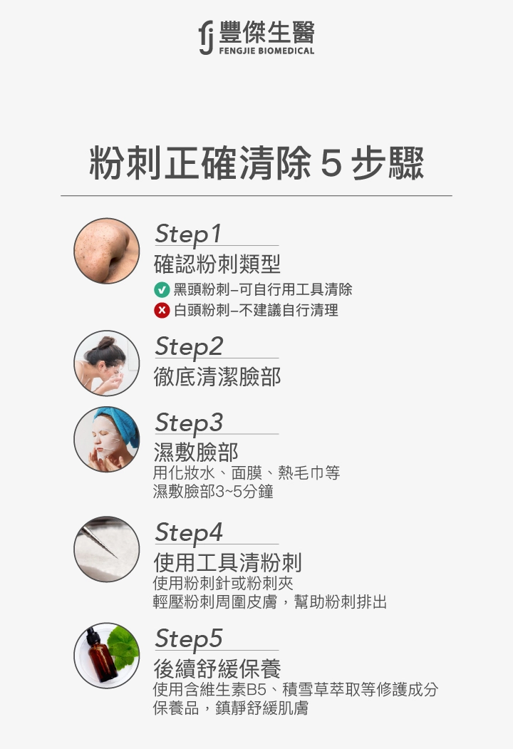 粉刺正確清除5步驟：Step1 確認粉刺類型，黑頭粉刺可自行清除，白頭粉刺不建議自行清理。Step2 徹底清潔臉部。Step3 濕敷臉部3-5分鐘。Step4 使用粉刺針或粉刺夾輕壓粉刺周圍皮膚。Step5 使用含維生素B5、積雪草萃取等修護成分保養品舒緩肌膚。