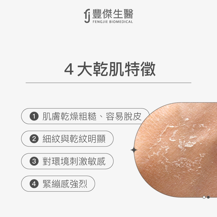 4大乾肌特徵：肌膚乾燥粗糙、容易脫皮，細紋與乾紋明顯，對環境刺激敏感，緊繃感強烈