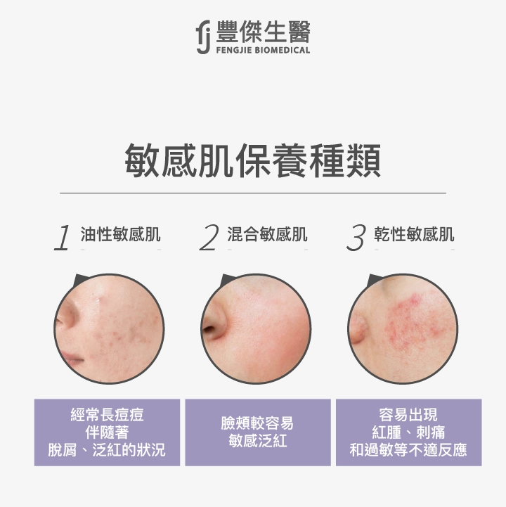 油性、混合、乾性肌介紹