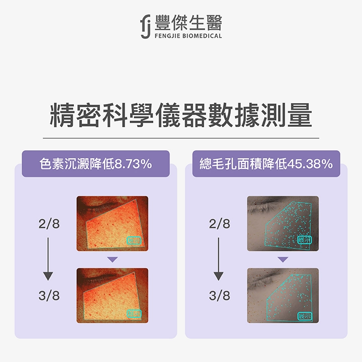 雪肌露淡斑實測2：精密科學儀器數據測量