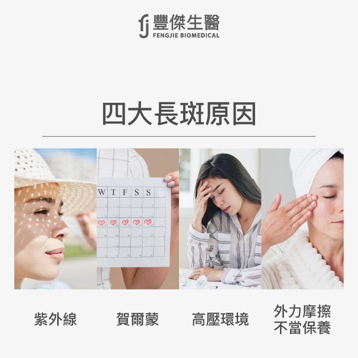 四大長斑原因：紫外線、賀爾蒙、高壓環境、外力摩擦、不當保養