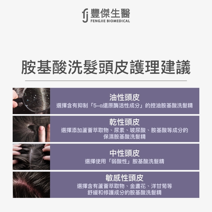 胺基酸洗髮頭皮護理，針對油性、乾性、中性、敏感性頭皮的4大建議