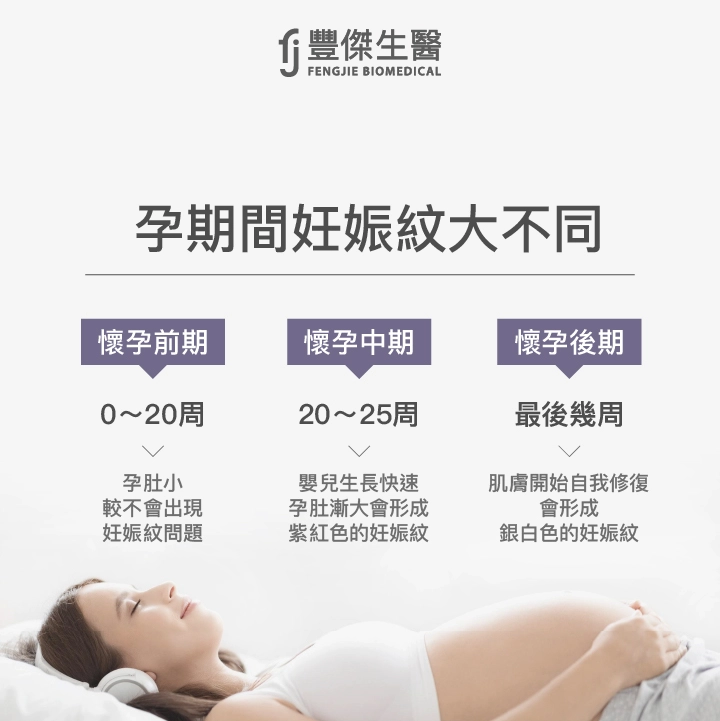 懷孕前期、懷孕中期、懷孕後期的妊娠紋