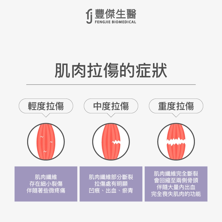 肌肉拉傷症狀有哪些