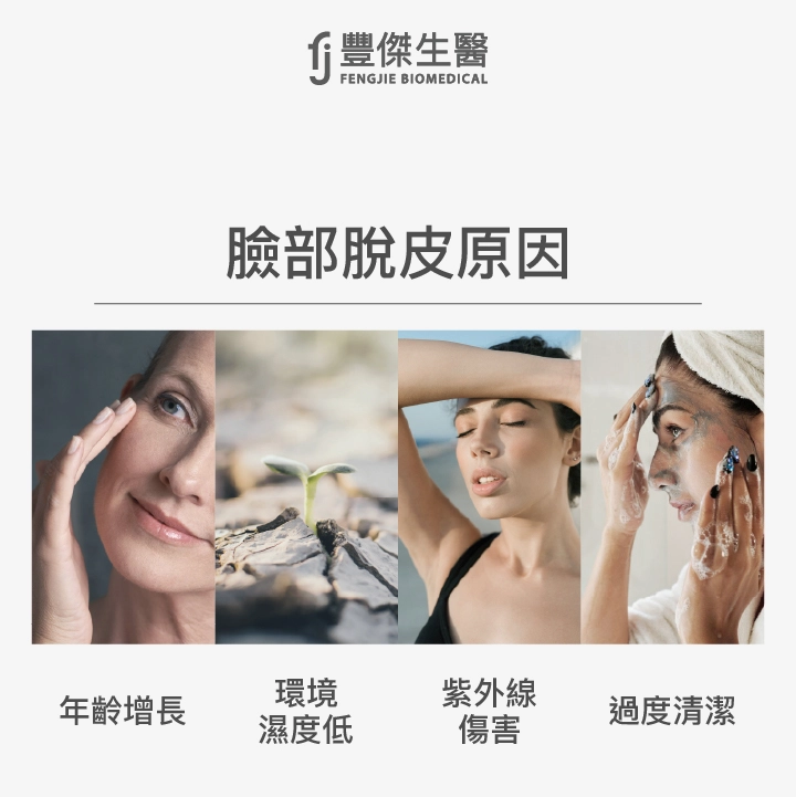 為什麼會臉部脫皮？4大原因解析！