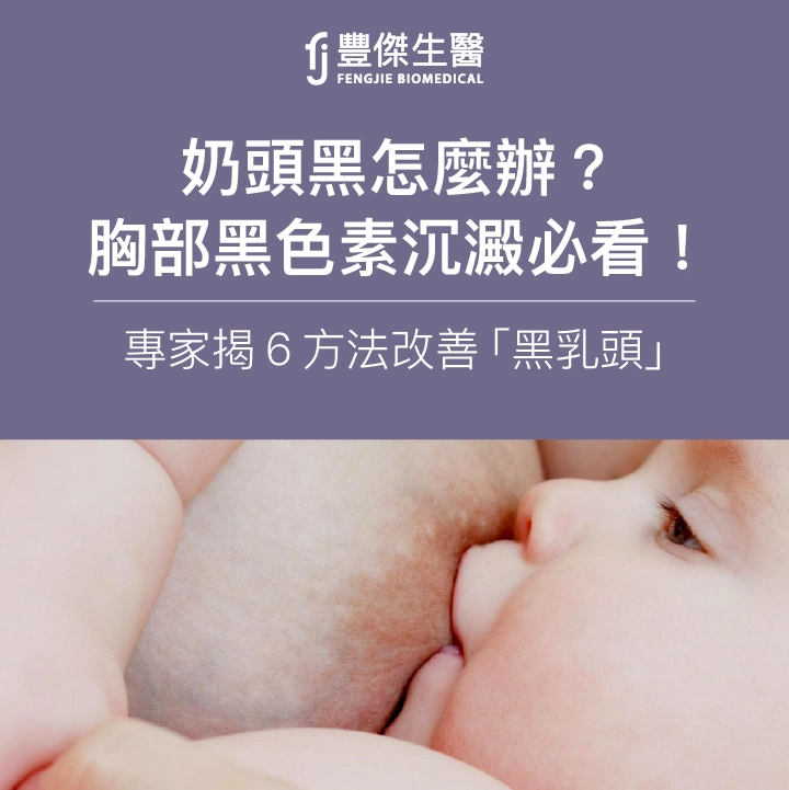 奶頭黑怎麼辦？胸部黑色素沉澱必看！專家揭6方法改善「黑乳頭」