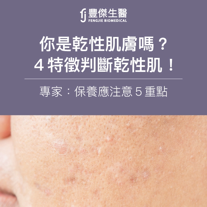 你是乾性肌膚嗎？4特徵判斷乾性肌！專家：保養應注意5重點
