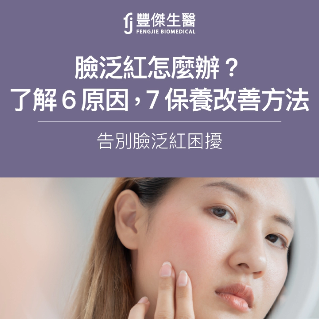 臉泛紅怎麼辦？了解6原因，掌握保養改善7方法，告別臉泛紅困擾