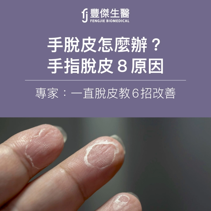 手指脫皮、乾燥怎麼辦？8大原因完整解析，專家教6招改善