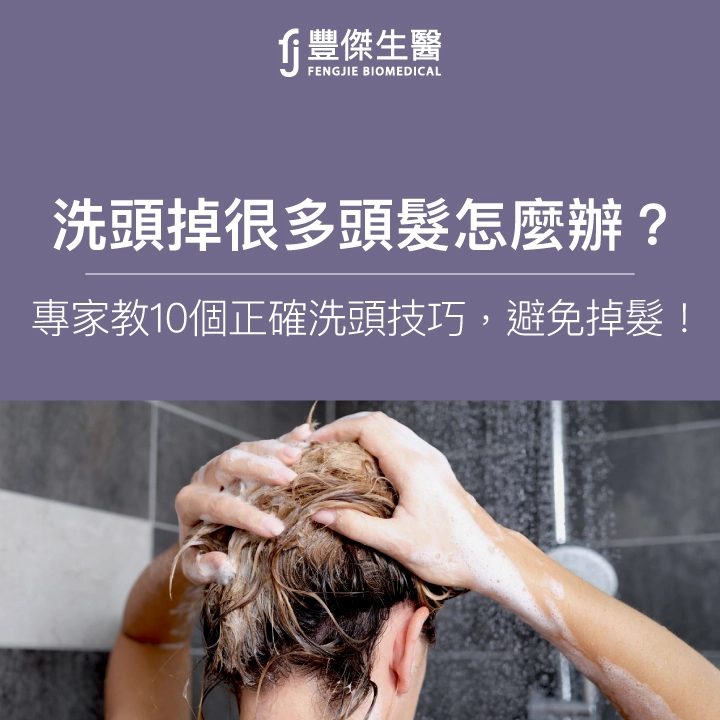 洗頭掉很多頭髮怎麼辦？專家教正確洗頭步驟、10個洗頭技巧！